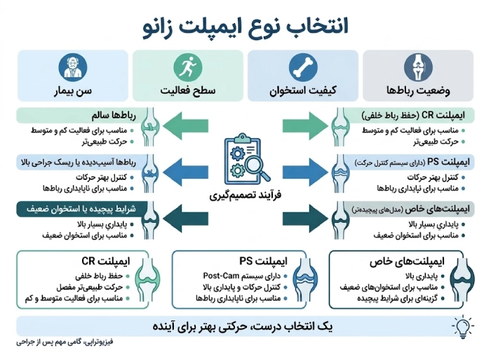 انتخاب نوع ایمپلنت