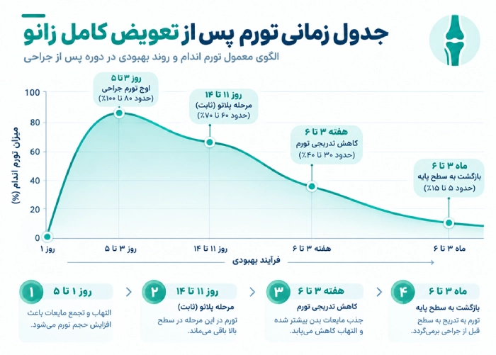 جدول زمانی تورم