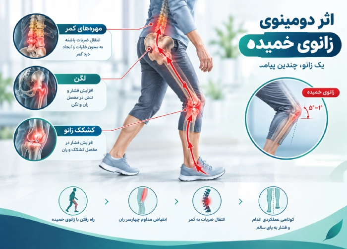 راه رفتن با زانوی خمیده 