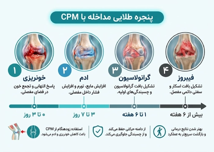 پنجره طلایی مداخله