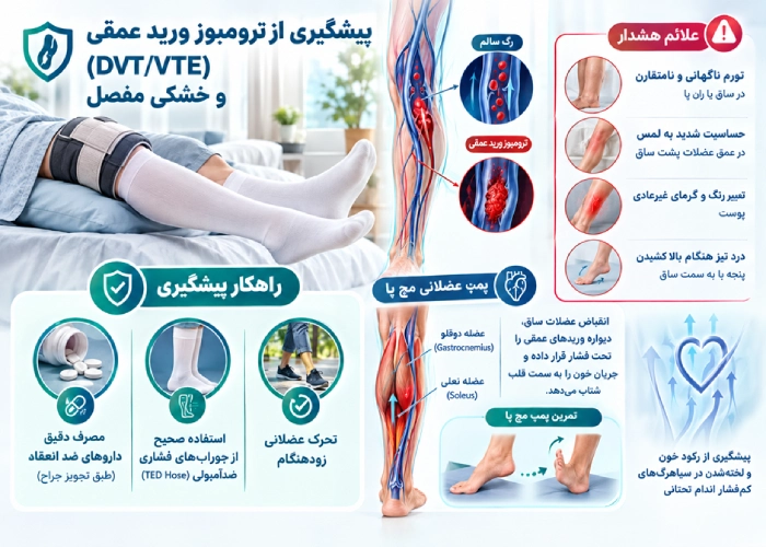 DVT/VTE