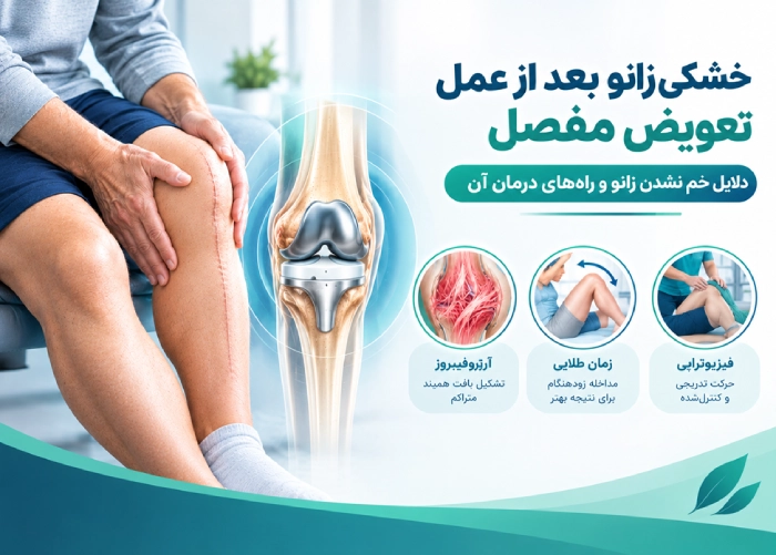Knee stiffness after joint replacement surgery