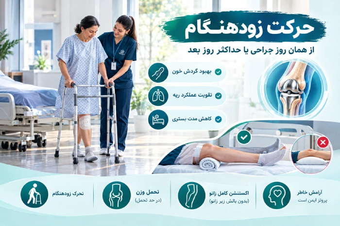 حرکت زودهنگام