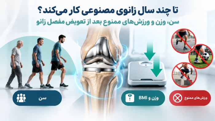 تا چند سال زانوی مصنوعی کار می‌کند؟