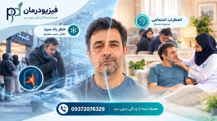 درمان فلج بلز صورت 
