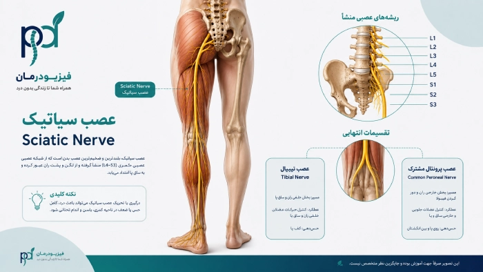 عصب سیاتیک چیست