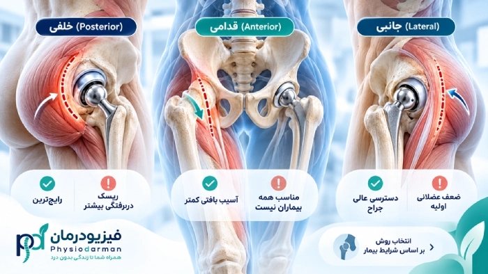 مقایسه جراحی تعویض مفصل هیپ