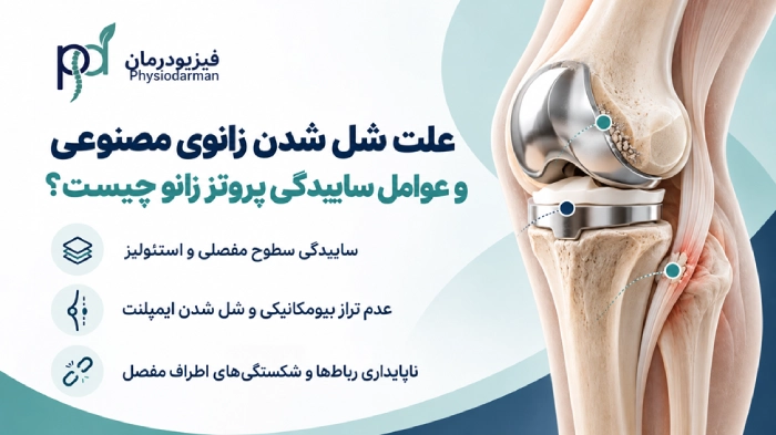 علت شل شدن زانوی مصنوعی